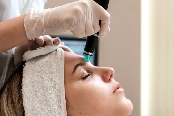 hydro-microdermabrasion-2
